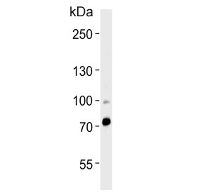 Western blot testing of human heart tissue lysate with ZNF219 antibody. Predicted molecular weight ~77 kDa.