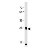 Western blot testing of human spleen tissue lysate with PRSS57 antibody. Predicted molecular weight ~30 kDa.
