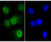 Immunofluorescent staining of fixed and permeabilized human A549 cells with Brachyury antibody (green) and DAPI nuclear stain (blue).