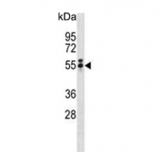 Western blot testing of human MDA-MB-453 cell lysate with Brachyury antibody. Predicted molecular weight ~47 kDa.