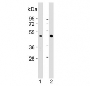 Western blot testing of human 1) A431 and 2) NCI-H460 cell lysate with Brachyury antibody. Predicted molecular weight ~47 kDa.