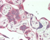 IHC testing of FFPE human placental tissue with Nuclear matrix protein 2 antibody. HIER: steam section in pH6 citrate buffer for 20 min and allow to cool prior to staining.