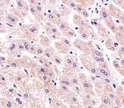 IHC testing of FFPE human liver tissue with PPP2R2A antibody. HIER: steam section in pH6 citrate buffer for 20 min and allow to cool prior to staining.