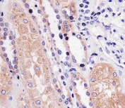 IHC testing of FFPE human kidney tissue with PPP2R2A antibody. HIER: steam section in pH6 citrate buffer for 20 min and allow to cool prior to staining.