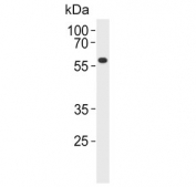 Western blot testing of human ZR-75-1 cell lysate with PPP2R2A antibody. Predicted molecular weight ~52 kDa.