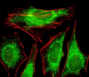 Immunofluorescent staining of human HeLa cells with PPP2R2A antibody (green) and anti-Actin (red).