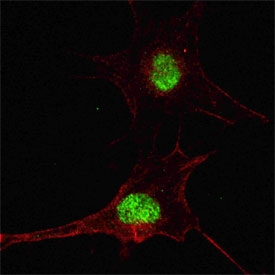 Immunofluorescent staining of fixed and permeabilized human SH-SY5Y cells with SOX2 antibody (green) and anti-Actin (red).