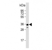 Western blot testing of human NCCIT cell lysate with SOX2 antibody. Predicted molecular weight ~34 kDa.