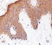 IHC testing of FFPE human skin tissue with Bleomycin hydrolase antibody. HIER: steam section in pH6 citrate buffer for 20 min and allow to cool prior to staining.