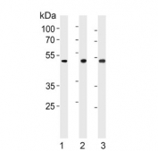 Western blot testing of 1) human L562, 2) mouse stomach and 3) rat stomach lysate with Bleomycin hydrolase antibody. Predicted molecular weight ~53 kDa.