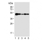 Western blot testing of human 1) HL60, 2) CCRF-CEM, 3) SH-SY5Y, 4) MOLT4 and 5) mouse Neuro-2a cell lysate with Bleomycin hydrolase antibody. Predicted molecular weight ~53 kDa.