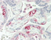 IHC testing of FFPE human placental tissue with VAMP-8 antibody. HIER: steam section in pH6 citrate buffer for 20 min and allow to cool prior to staining.