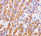 IHC testing of FFPE human stomach tissue with VAMP-8 antibody. HIER: steam section in pH6 citrate buffer for 20 min and allow to cool prior to staining.