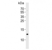 Western blot testing of human brain tissue lysate with Hemoglobin subunit gamma-2 antibody. Predicted molecular weight ~16 kDa.