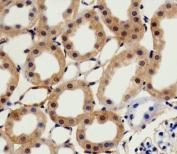 IHC testing of FFPE rat kidney tissue with CSNK2A1 antibody. HIER: steam section in pH6 citrate buffer for 20 min and allow to cool prior to staining.
