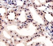 IHC testing of FFPE human kidney tissue with CSNK2A1 antibody. HIER: steam section in pH6 citrate buffer for 20 min and allow to cool prior to staining.