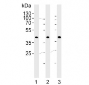 Western blot testing of human 1) A431, 2) HeLa and 3) HepG2 cell lysate with CSNK2A1 antibody. Predicted molecular weight ~45 kDa.