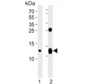 Western blot testing of human 1) K562 and 2) placenta lysate with HBG2 antibody. Predicted molecular weight ~16 kDa.