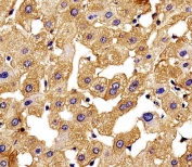 IHC testing of FFPE human liver tissue with HBG2 antibody. HIER: steam section in pH6 citrate buffer for 20 min and allow to cool prior to staining.