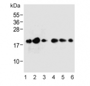 Western blot testing of 1) human cerebellum, 2) human brain, 3) human SH-SY5Y, 4) mouse brain, 5) mouse cerebellum and 6) rat brain tissue lysate with FXYD6 antibody. Expected molecular weight: 11-20 kDa.