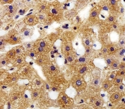 IHC testing of FFPE human liver tissue with FXYD6 antibody. HIER: steam section in pH6 citrate buffer for 20 min and allow to cool prior to staining.