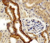 IHC testing of FFPE mouse kidney tissue with FXYD6 antibody. HIER: steam section in pH6 citrate buffer for 20 min and allow to cool prior to staining.