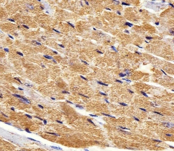IHC testing of FFPE mouse heart tissue with FABP3 antibody. HIER: steam section in pH6 citrate buffer for 20 min and allow to cool prior to staining.