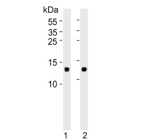 Western blot testing of human 1) heart and 2) skeletal muscle tissue lysate with FABP3 antibody. Predicted molecular weight ~15 kDa.
