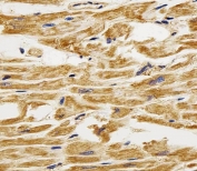IHC testing of FFPE human heart tissue with FABP3 antibody. HIER: steam section in pH6 citrate buffer for 20 min and allow to cool prior to staining.