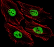 Immunofluorescent staining of human HeLa cells with Trim24 antibody (green) and anti-Actin (red).