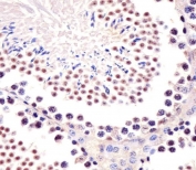 IHC testing of FFPE mouse testis tissue with Trim24 antibody. HIER: steam section in pH6 citrate buffer for 20 min and allow to cool prior to staining.