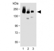 Western blot testing of 1) human brain, 2) mouse brain and 3) rat brain tissue lysate with Neural cell adhesion molecule 1 antibody. Predicted molecular weight: ~110 kDa (soluble fragment), ~120/125 kDa (GPI-anchored), 140/180 kDa (transmembrane isoforms).