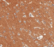 IHC testing of FFPE human brain tissue with Neural cell adhesion molecule 1 antibody. HIER: steam section in pH9 EDTA for 20 min and allow to cool prior to staining.