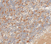 IHC testing of FFPE human cerebellum tissue with Neural cell adhesion molecule 1 antibody. HIER: steam section in pH9 EDTA for 20 min and allow to cool prior to staining.