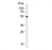 Western blot testing of human brain tissue lysate with PIP4K2 alpha antibody. Predicted molecular weight ~46 kDa.