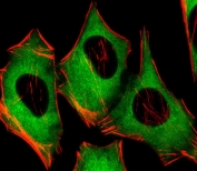 Immunofluorescent staining of fixed and permeabilized human HeLa cells with PIP4K2 alpha antibody (green) and anti-Actin (red).