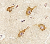 IHC testing of FFPE human brain tissue with PIP4K2 alpha antibody. HIER: steam section in pH6 citrate buffer for 20 min and allow to cool prior to staining.
