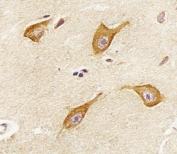 IHC testing of FFPE human brain tissue with PIP4K2 alpha antibody. HIER: steam section in pH6 citrate buffer for 20 min and allow to cool prior to staining.