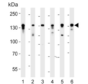 Western blot testing of 1) human Jurkat, 2) human HT-29 and mouse 3) BA/F9, 4) F9, 5) cerebellum and 6) testis tissue lysate with Ctr9 antibody. Predicted molecular weight ~133 kDa.
