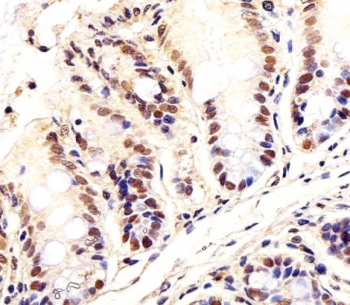 IHC testing of FFPE mouse colon tissue with Ctr9 antibody. HIER: steam section in pH6 citrate buffer for 20 min and allow to cool prior to staining.