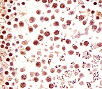 IHC testing of FFPE mouse testis tissue with Ctr9 antibody. HIER: steam section in pH6 citrate buffer for 20 min and allow to cool prior to staining.
