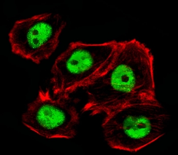 Immunofluorescent staining of human A431 cells with Ctr9 antibody (green) and anti-Actin (red).