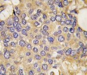 IHC testing of FFPE human testis tissue with SMURF1 antibody. HIER: steam section in pH6 citrate buffer for 20 min and allow to cool prior to staining.