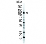 Western blot testing of human HL60 cell lysate with Ubiquitin-like modifier-activating enzyme 1 antibody. Expected molecular weight: ~118/114 kDa (isoforms a/b).