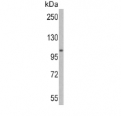 Western blot testing of mouse stomach tissue lysate with Ubiquitin-like modifier-activating enzyme 1 antibody. Expected molecular weight: ~118/114 kDa (isoforms a/b).