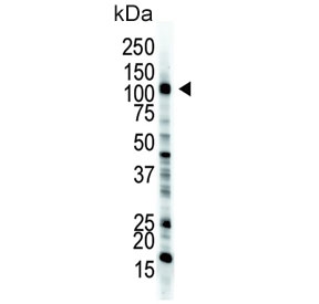 Western blot testing of mouse stomach tissue lysate with Ubiquitin-like modifier-activating enzyme 1 antibody. Expected molecular weight: ~118/114 kDa (isoforms a/b).