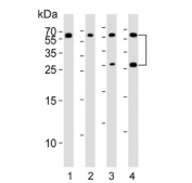 Western blot testing of 1) human SW480, 2) mouse kidney, 3) human brain and 4) human kidney tissue lysate with FGF9 antibody. Predicted molecular weight ~23 kDa with a possible 45-55 kDa dimer.
