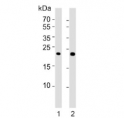 Western blot testing of human 1) brain and 2) kidney tissue lysate with FGF9 antibody. Predicted molecular weight ~23 kDa with a possible 45-55 kDa dimer.