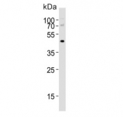 Western blot testing of human kidney tissue lysate with NPY2R antibody. Predicted molecular weight ~43 kDa.