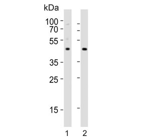 Western blot testing of 1) mouse brain and 2) rat brain tissue lysate with NPY2R antibody. Predicted molecular weight ~43 kDa.